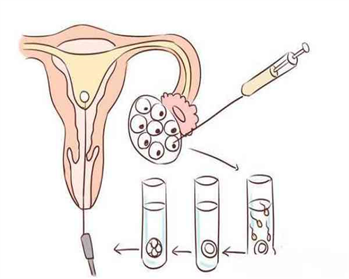 哪里有可以供卵的医院&职业代妈,2026邢台试管婴儿医院排名，邢台不孕不育专科