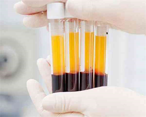 中晚孕B超单怎么看？要吗？