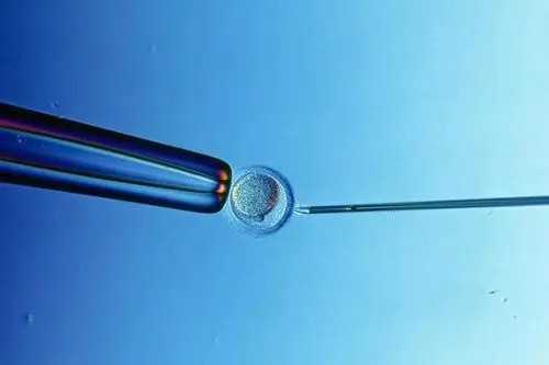 供卵能做做无创dna吗&供卵指定坤和,经期小腹冷是什么原因