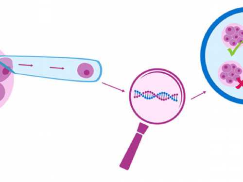 二代试管婴儿可以选择性别吗?&卵巢早衰轻度能怀孕,备孕时发现患有子宫肌瘤，