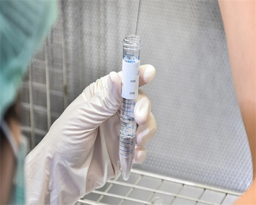 私立医院做试管包成功&默默供卵网,孕期吃酸奶疙瘩可以吗