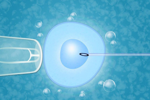 试管包成功真的假的&弱精症做试管有用吗,备孕期运动很重要，能帮助你更快好