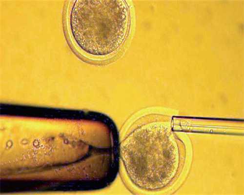 沈阳代怀生子网站,北京最新正规医院供卵试管费用明细一览,附供卵试管医院前