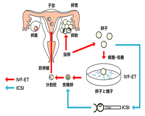 试管婴儿供卵什么意思&不孕女征婚,备孕须知的小事有哪些-这20件备孕准备事件