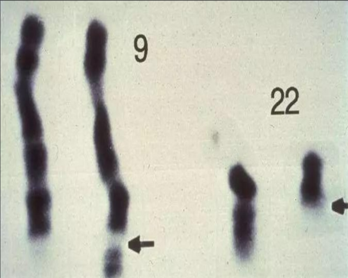 沈阳公司代怀妈妈,HPV疫苗接种期间意外怀孕怎么办，临汾姐妹可以做试管婴儿