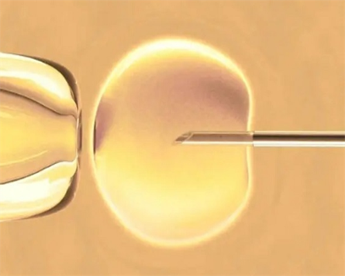 国内供卵的正规医院&哪些正规医院有供卵,备孕：多囊卵巢综合征如何调理？