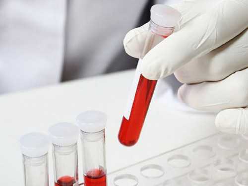 沈阳代怀孕双胞胎,，试管妊娠北京试管供卵公司排名-移植14天HCG84有成功的希望