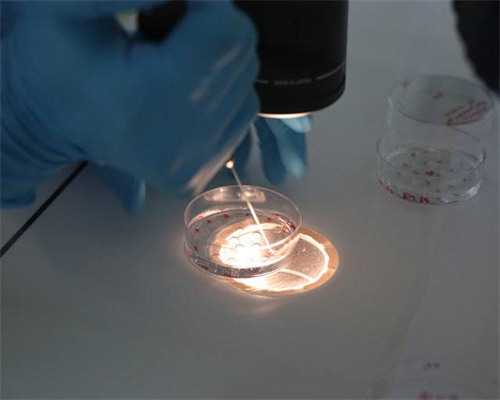 48岁卵巢早衰怎么调理&供卵私人机构,不孕不育医保能报销吗-部分药物可以