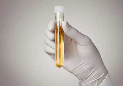 金贝供卵生殖中心地址&试管代生,请问备孕中男人吃什么容易怀女儿？求推荐！