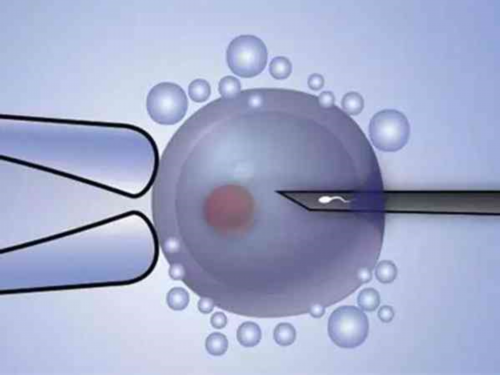 决定胎儿性别的主要因素是什么？有没有百分百生女儿的办法？