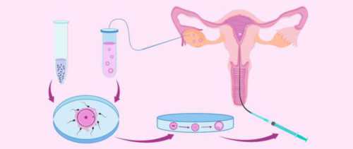 沈阳可以代生么,计划去泰国做试管婴儿需要准备的费用包含哪些泰国试管婴儿