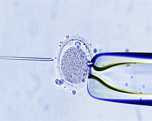 沈阳包成功代孕价格,成都做试管移植前为何要做宫腔镜?-生男生女八卦图图片
